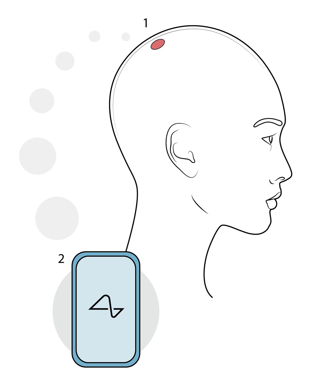 Neuralink Patient Journey