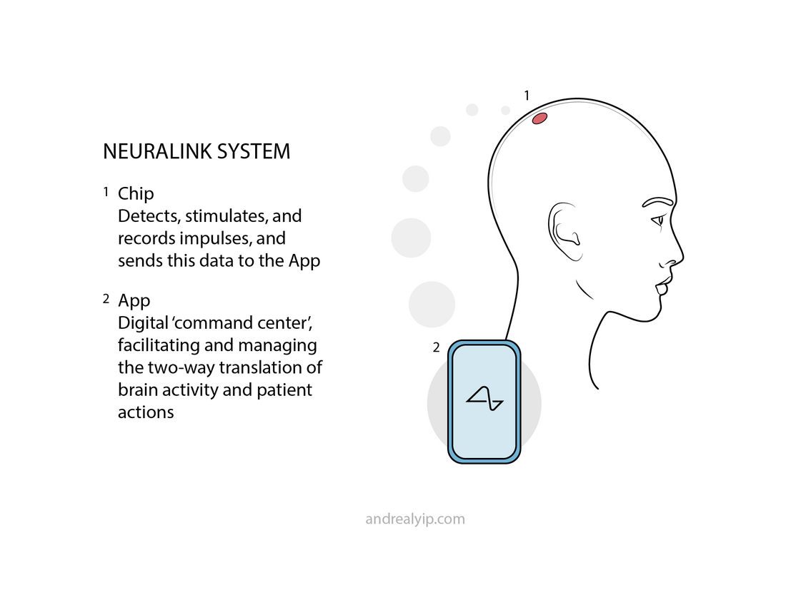 Diagram of a head in profile: a chip on the scalp detects, stimulates and records impulses and sends the data to an App, a digital command center managing the two-way translation of brain activity and patient actions